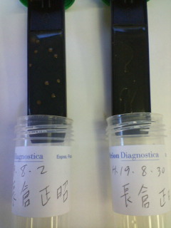 ラクトバチルス菌の比較